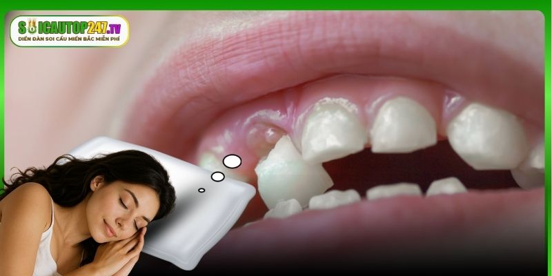Giải nghĩa giấc mộng nhổ răng bị lung lay